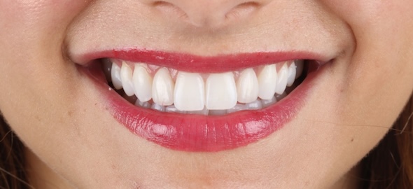 smile gallery image