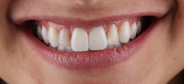 smile gallery image