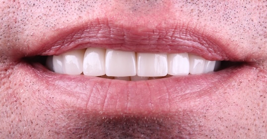 smile gallery image