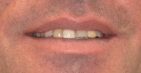 smile gallery image