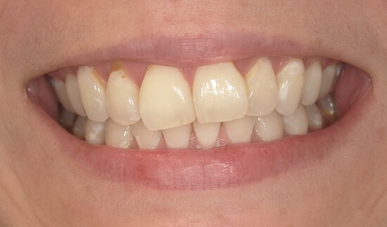Trinity Before