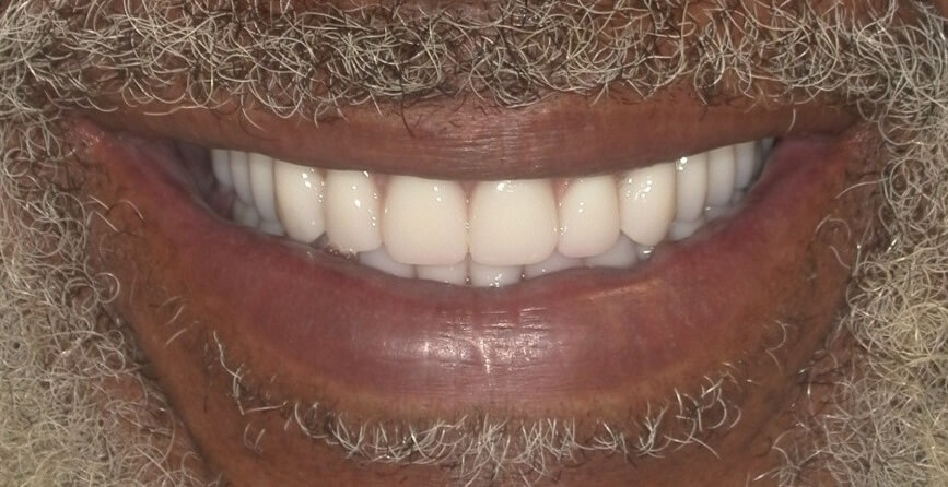 Jamie After