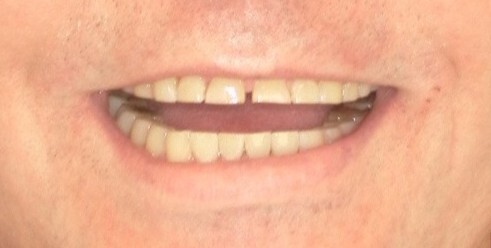 Jack before
