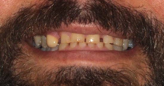 John Before