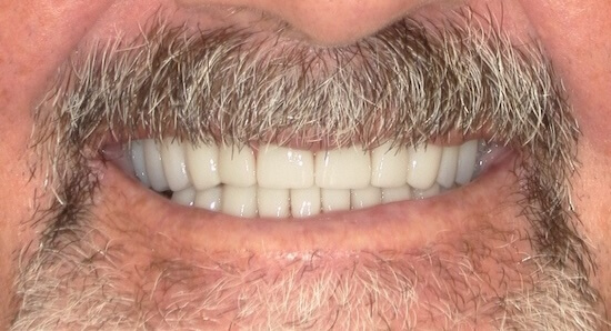 After