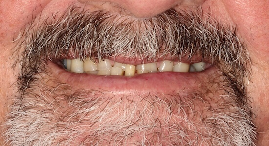 Before