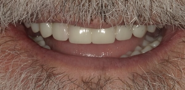 Rick After