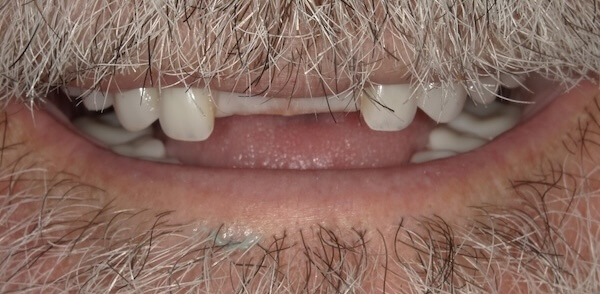Rick Before