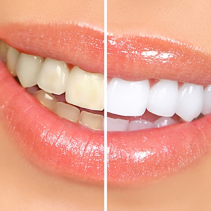 cosmetic 6