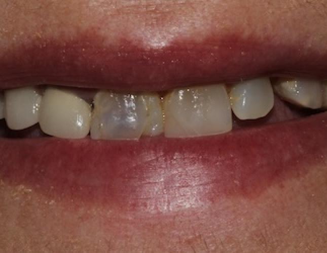 Phyllis before Phyllis before
