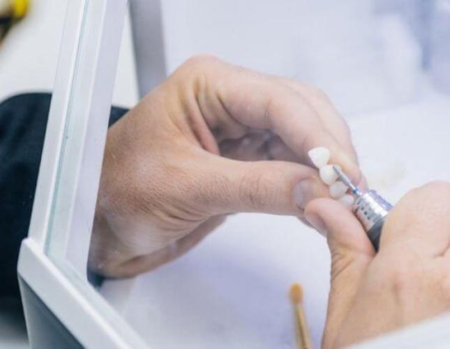 Common Issues Addressed by Restorative Dentistry: From Cavities to Missing Teeth